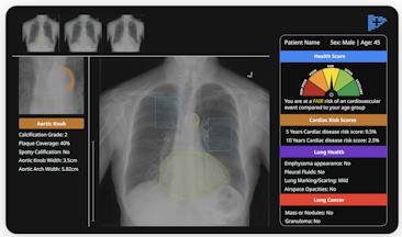 AI Imaging Health Solution